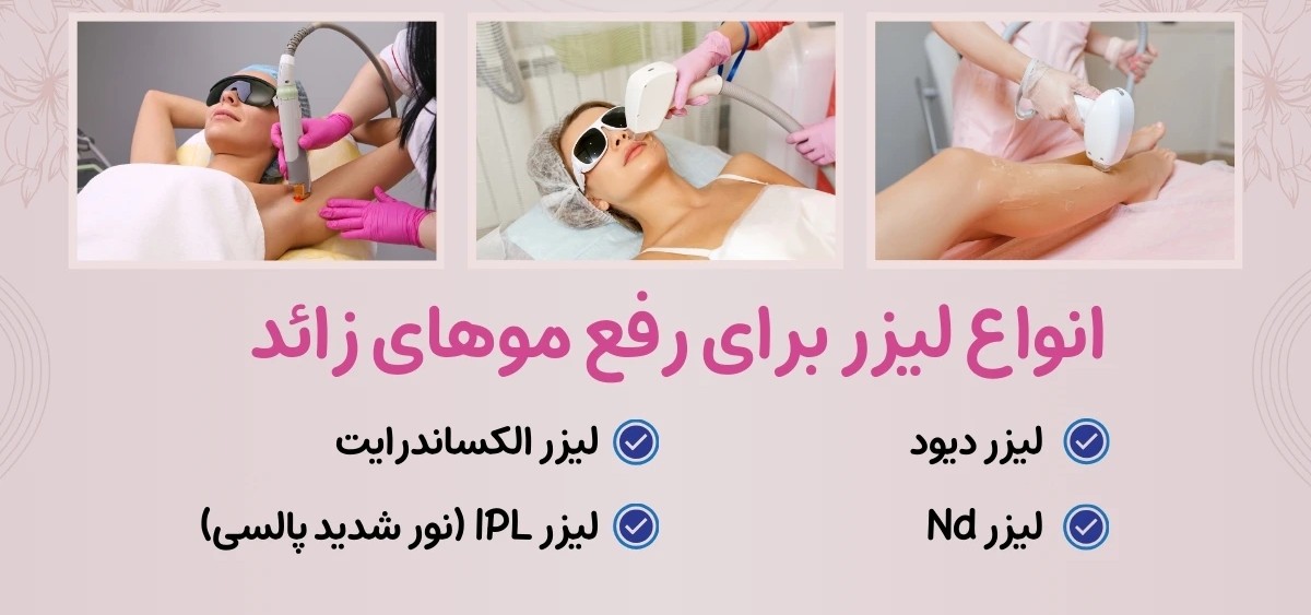 دانلود انواع روش‌های لیزر برای حذف موهای زائد رایگان