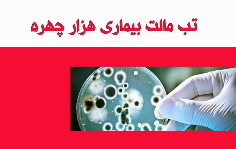 دانلود تب مالت چیست؟ رایگان