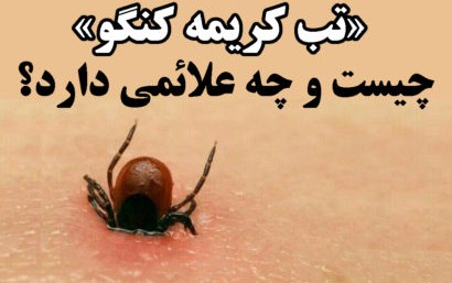 دانلود تب کریمه کنگو چیست و چه نشانه‌هایی دارد؟ رایگان