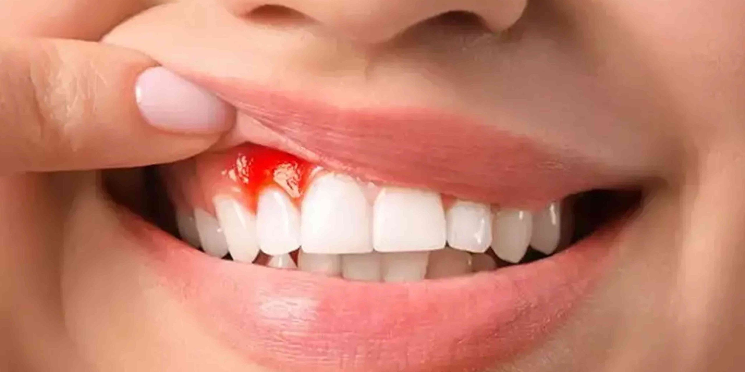 دانلود عوارض استفاده‌ی نادرست از نخ دندان رایگان