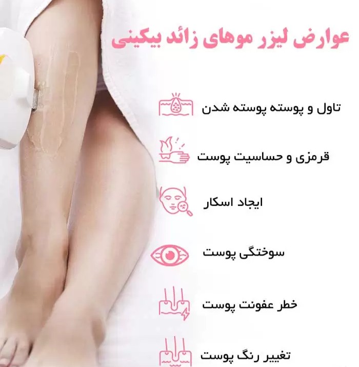 دانلود عوارض ممکن در لیزر رایگان