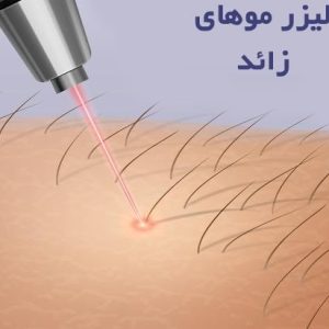 فواید و عوارض لیزر موهای زائد